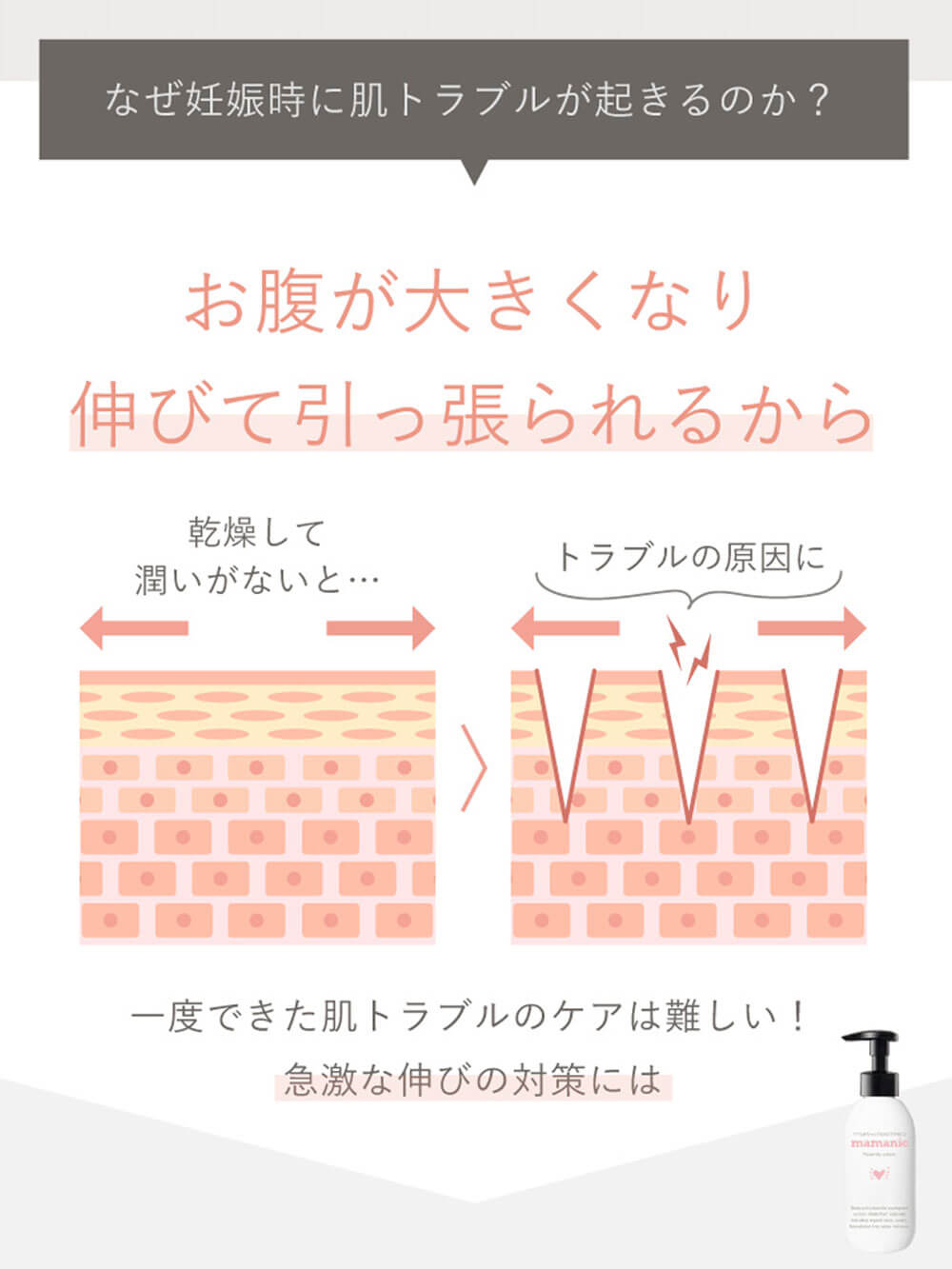 なぜ妊娠時に肌トラブルが起きるのか?